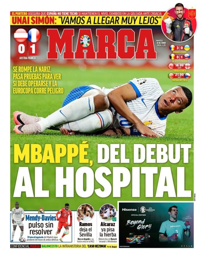 El impacto mundial de la fractura de Mbappé