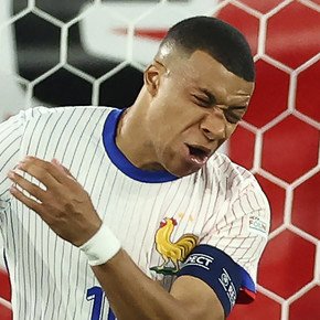 Mbappé sufrió un tremendo golpe, con fractura