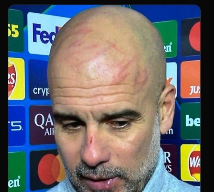 Guardiola, lastimado.