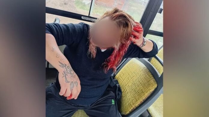 La atacaron con un caño en el colectivo porque no las invitó a la fiesta de 15 de su hija