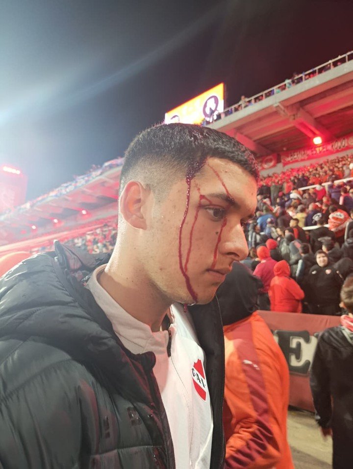 Un hincha herido en la tribuna.