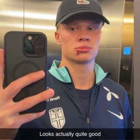 El insólito accidente que sufrió Haaland al bajar del micro con la selección de Noruega