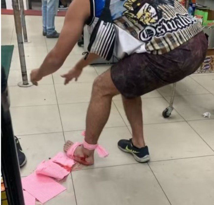 Uno de los hinchas heridos del Vasco da Gama. (Foto: Reproducción)