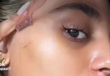 Ana Molina, dermatóloga: «No es que el afeitado haga que el pelo crezca más fuerte; es que otros métodos de depilación lo debilitan»