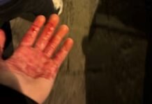 Graves incidentes en la previa del Napoli vs. Chelsea por Champions: dos hinchas fueron acuchillados