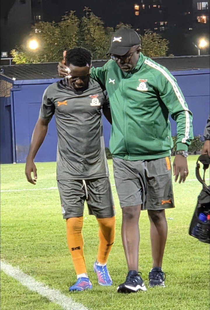 El jugador de Zambia con su cara cortada (Foto: Prensa Zambia).