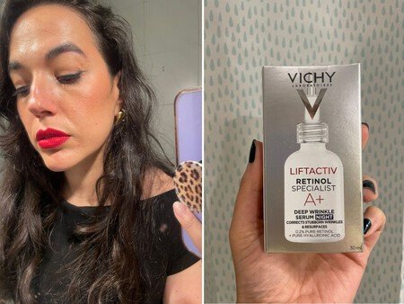 Seis Meses Usando Retinol Efectos Y Aspecto De La Piel 4