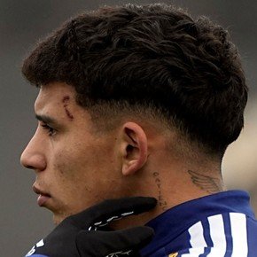 Terrible: así le quedó la cara a Leo Flores tras el patadón en el amistoso de Boca con Paranaense