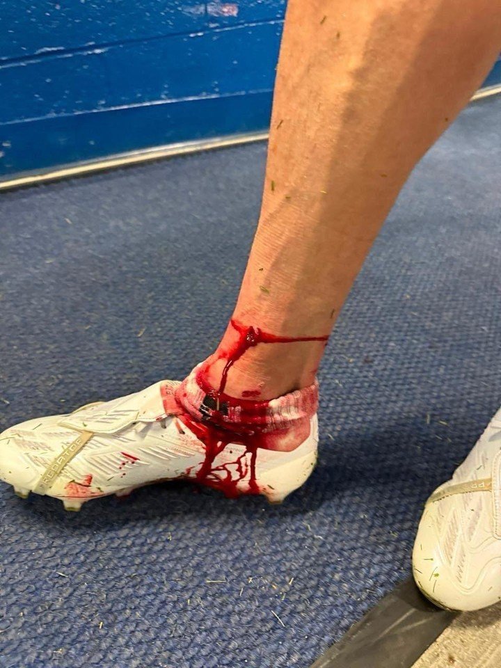 Así le quedó la pierna a Lucas Di Yorio. (Foto: X)