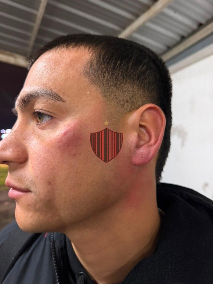 Los jugadores de Patronato fueron agredidos por los barras.