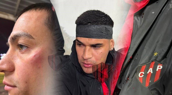 Los jugadores de Patronato fueron agredidos por los barras.