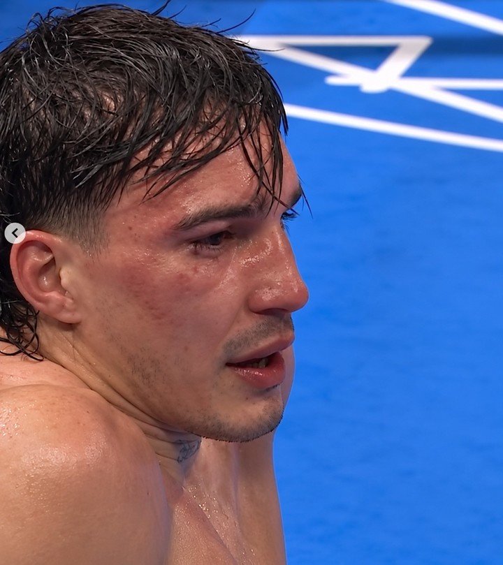 El gesto de Alan Cháves tras ser derribado por el dominicano Eridson García.
(DAZNBoxing en X). 